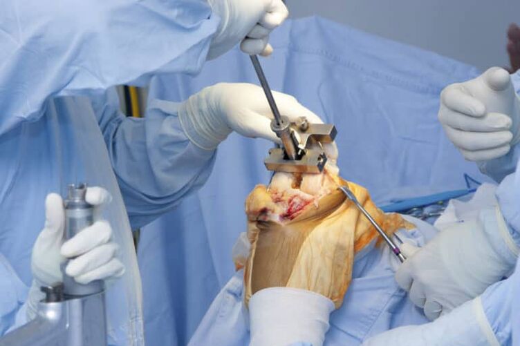 operace kolenní artrózy