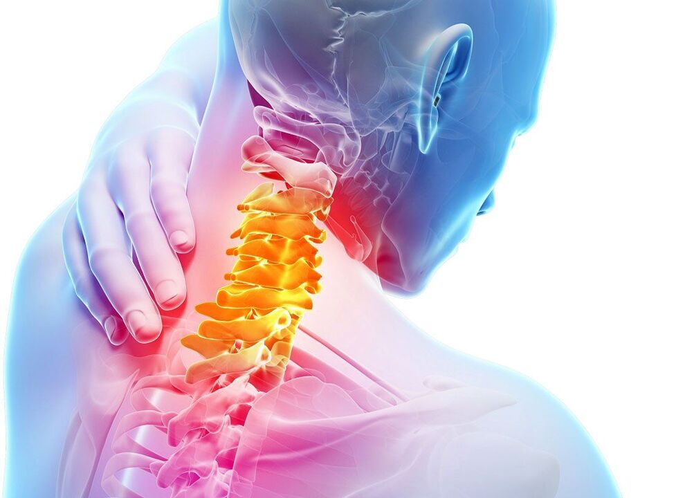 příznaky spinální osteochondrózy
