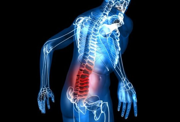 Příznaky osteochondrosy