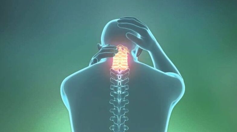 Osteochondroza v oblasti děložního čípku