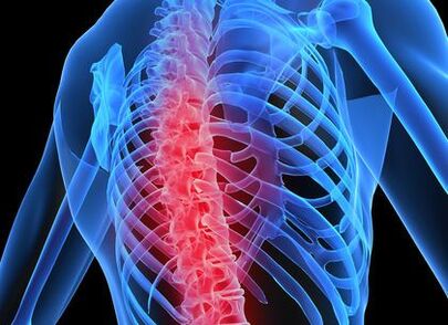 osteochondróza hrudní páteře