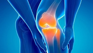 artróza kolene