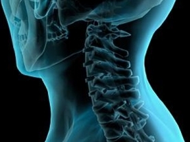 metody diagnostiky cervikální osteochondrózy